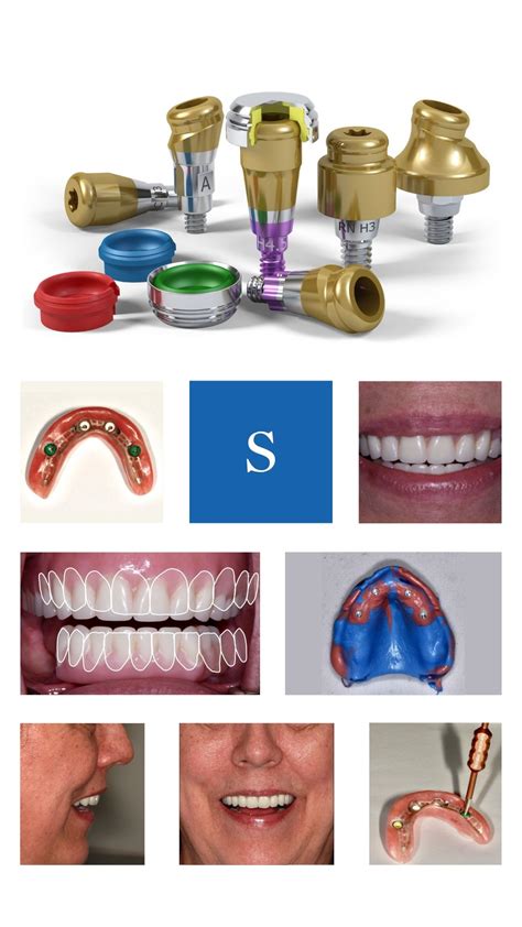 zirca metal housing attachments denture|Novaloc: A First.